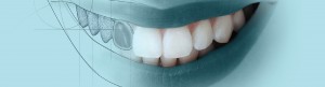 Cabecera tratamiento de estética dental en clínica Cimer Almansa